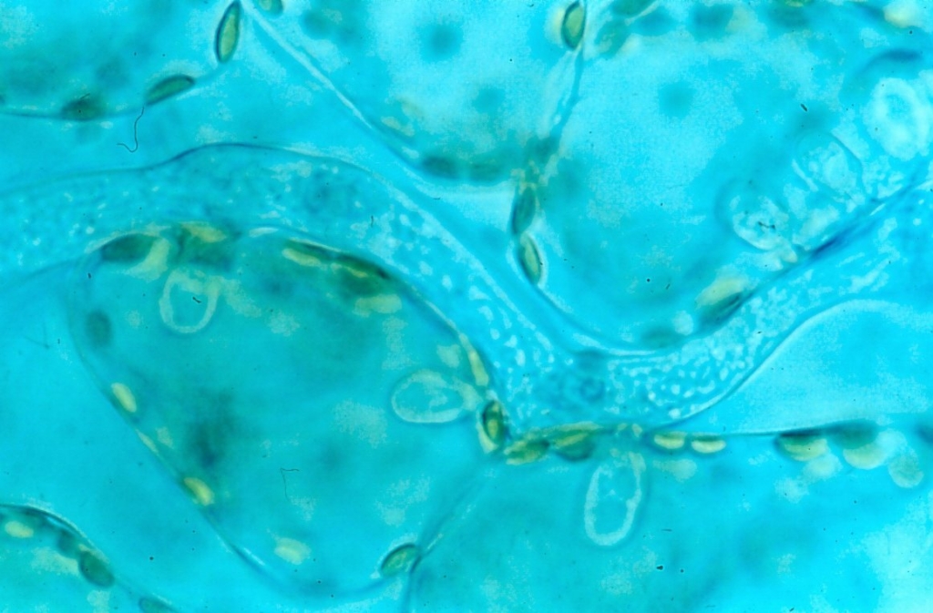 Au microscope, les suçoirs du parasite dans les cellules de la laitue