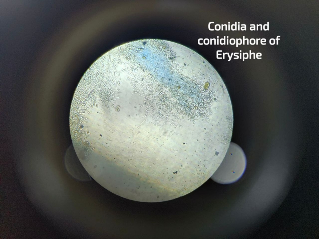 Chaînes de spores (conidies) d'un oïdium, au microscope